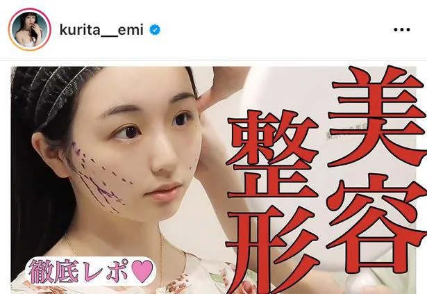 ※画像は、くりえみ(kurita__emi)オフィシャルInstagramのスクリーンショット