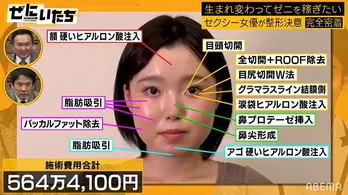 かまいたち、約564万円の美容整形セクシー女優に密着 術後の晴れやかな表情に「自信に満ちあふれてる」<ぜにいたち>