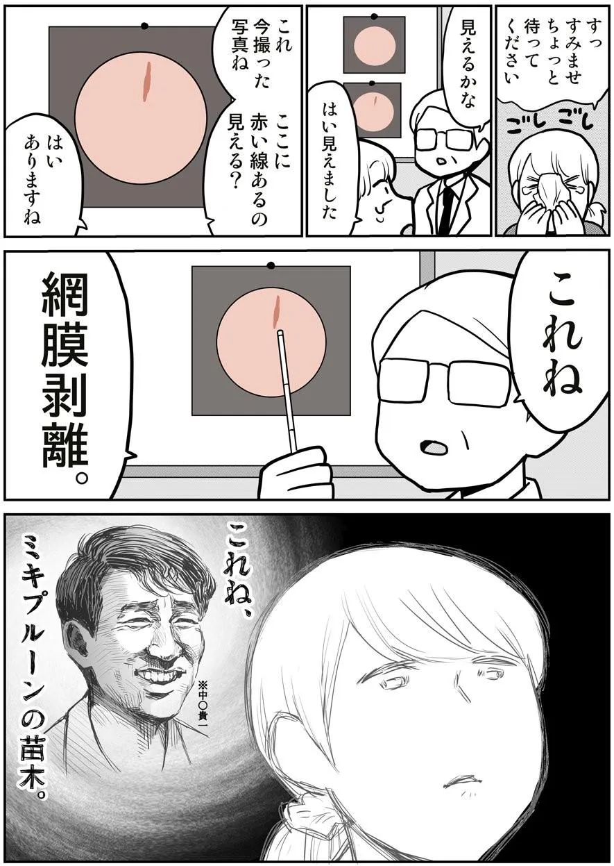 網膜剥離になった話 (4/8)