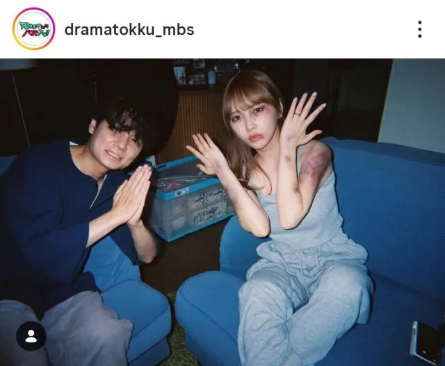 【写真】痛々しいアザのメイクを見せる与田祐希