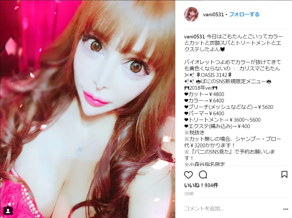 【写真を見る】自身のインスタで胸元を強調する整形サイボーグことヴァニラ。豊胸手術費用は200～300万円という