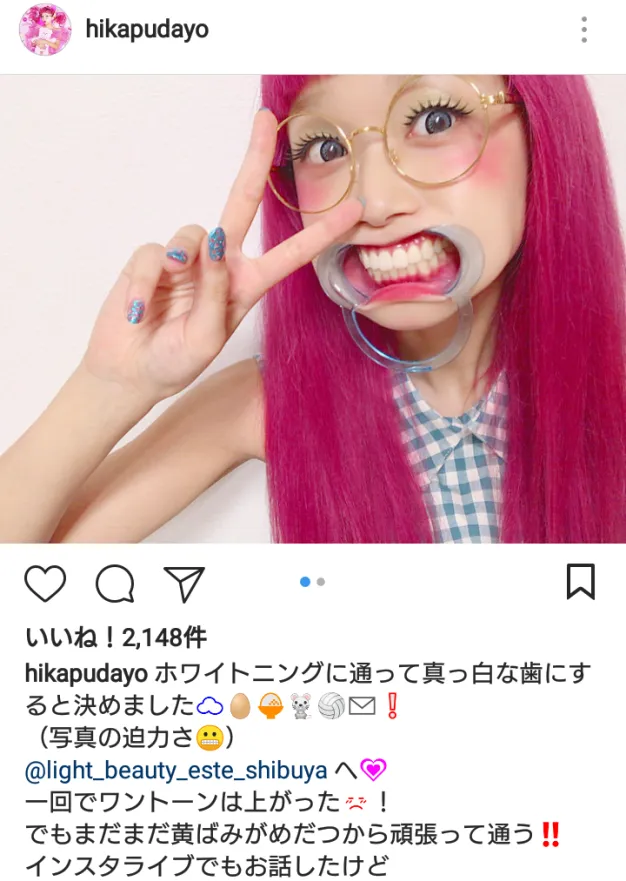 【写真を見る】ひかぷぅがインパクト大なホワイトニング姿を公開！