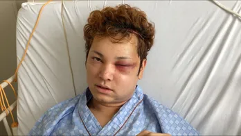 間瀬翔太 10万人に1人「脳動静脈奇形」に侵され、毎日死ぬことばかりを…