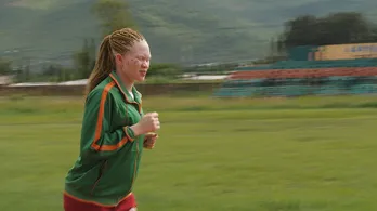 アルビノが襲撃され、体を高値取引される実態をザンビアに探る<JNNドキュメンタリー ザ・フォーカス>